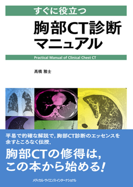  すぐに役立つ胸部CT診断マニュアル