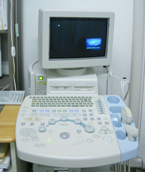 超音波検査